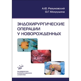 Эндохирургические операции у новорожденных Разумовский А.Ю. 2015 г. (МИА) Эндохирургические операции у новорожденных Разумовский А.Ю. 2015 г. (МИА)