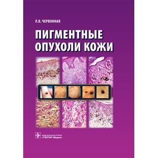 Пигментные опухоли кожи Червонная Л.В. 2016 г. (Гэотар)
