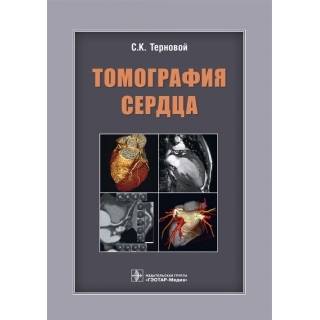 Томография сердца С. К. Терновой 2018 г. (Гэотар)