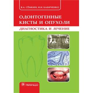Одонтогенные кисты и опухоли (диагностика и лечение) В. А. Сёмкин 2017 г. (Гэотар) Одонтогенные кисты и опухоли (диагностика и лечение) В. А. Сёмкин 2017 г. (Гэотар)