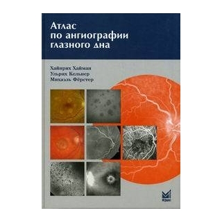 Атлас по ангиографии глазного дна Хайман Х. 2008 г. (МЕДпресс) Атлас по ангиографии глазного дна Хайман Х. 2008 г. (МЕДпресс)