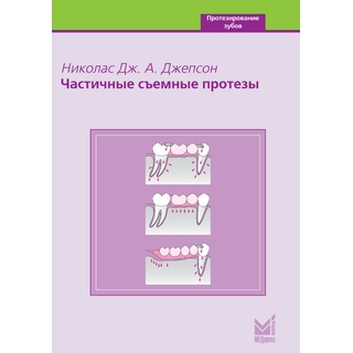 Частичные съемные протезы Джепсон Н.Дж.А. 2006 г. (МЕДпресс)
