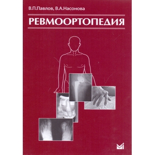 Ревмоортопедия Павлов В.П. 2017 г. (МЕДпресс) Ревмоортопедия Павлов В.П. 2017 г. (МЕДпресс)