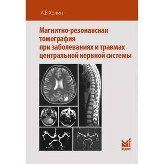 Магнитно-резонансная томография при заболеваниях и травмах центральной нервной системы Холин 2019 г. (МЕДпресс)