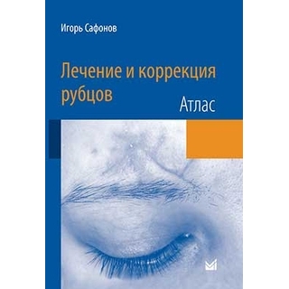 Лечение и коррекция рубцов. Атлас Сафонов 2015 г. (МЕДпресс) Лечение и коррекция рубцов. Атлас Сафонов 2015 г. (МЕДпресс)