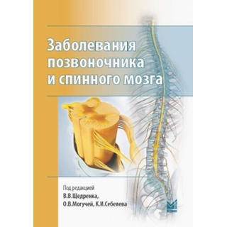 Заболевания позвоночника и спинного мозга. Щедренок 2018 г. (МЕДпресс) Заболевания позвоночника и спинного мозга. Щедренок 2018 г. (МЕДпресс)