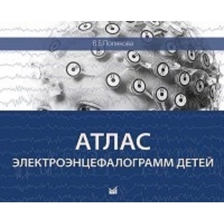 Атлас электроэнцефалограмм детей Полякова 2016 г. (МЕДпресс) Атлас электроэнцефалограмм детей Полякова 2016 г. (МЕДпресс)