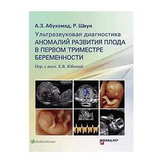 Ультразвуковая диагностика аномалий развития плода в первом триместре беременности. А.З. Абухамад Р. Шауи 2019 г. (Видар) Ультразвуковая диагностика аномалий развития плода в первом триместре беременности. А.З. Абухамад Р. Шауи 2019 г. (Видар)