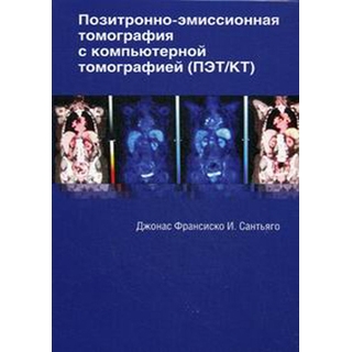 Позитронно-эмиссионная томография с компьютерной томографией Дж. И. Сантьяго 2017 г. (Издательство Панфилова) Позитронно-эмиссионная томография с компьютерной томографией Дж. И. Сантьяго 2017 г. (Издательство Панфилова)