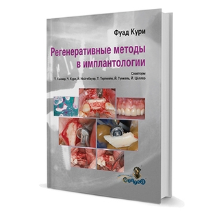 Регенеративные методы в имплантологии Фуад Кури 2013 г. (Дентал-Азбука)