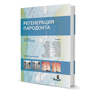 Регенерация пародонта А. Скулеан 2012 г. (Дентал-Азбука)