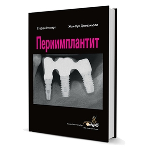 Периимплантит. С. Ренверт , Ж. Джованьоли 2014 г. (Дентал-Азбука) Периимплантит. С. Ренверт , Ж. Джованьоли 2014 г. (Дентал-Азбука)