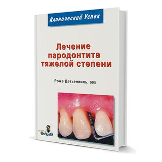 Лечение пародонтита тяжелой степени Роже Детьенвиль 2008 г. (Дентал-Азбука) Лечение пародонтита тяжелой степени Роже Детьенвиль 2008 г. (Дентал-Азбука)