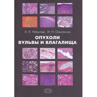 Опухоли вульвы и влагалища Нейштадт 2019 г. (Фолиант) Опухоли вульвы и влагалища Нейштадт 2019 г. (Фолиант)