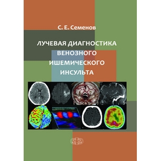 Лучевая диагностика венозного ишемического инсульта Семенов 2018 г. (Фолиант)