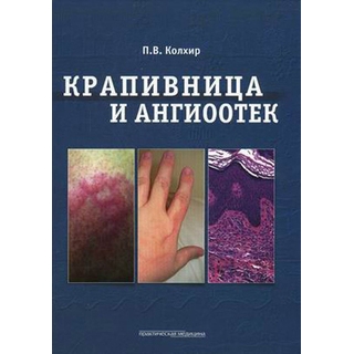 Крапивница и ангиоотек Колхир 2012 г. (Практическая медицина) Крапивница и ангиоотек Колхир 2012 г. (Практическая медицина)