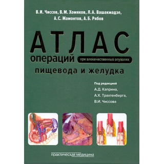 Атлас операций при злокачественных опухолях пищевода и желудка Чиссов 2016 г. (Практическая медицина) Атлас операций при злокачественных опухолях пищевода и желудка Чиссов 2016 г. (Практическая медицина)