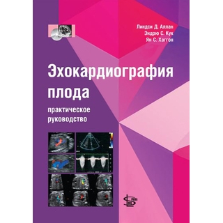 Эхокардиография плода Аллан 2018 г. (Логосфера) Эхокардиография плода Аллан 2018 г. (Логосфера)