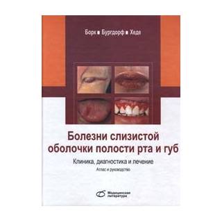 Болезни слизистой оболочки полости рта и губ. Клиника, диагностика и лечение  К. Борк В. 2020 г. (Медицинская литература)