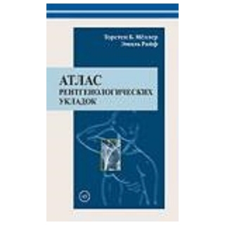 Атлас рентгенологических укладок Т. Б. Мёллер 2008 г. (Медицинская литература) Атлас рентгенологических укладок Т. Б. Мёллер 2008 г. (Медицинская литература)