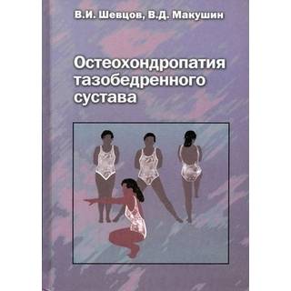 Остеохондропатия тазобедренного сустава Шевцов 2007 г. (Медицина)