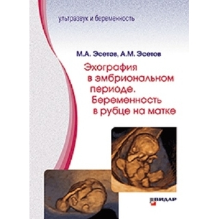 Эхография в эмбриональном периоде. Беременность в рубце на матке. М.А. Эсетов, А.М. Эсетов Эхография в эмбриональном периоде. Беременность в рубце на матке. М.А. Эсетов, А.М. Эсетов