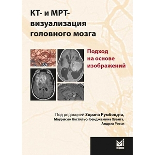 КТ- и МРТ- визуализация головного мозга. Подход на основе изображений Румболдт З. 2020 г. (МЕДпресс-информ) КТ- и МРТ- визуализация головного мозга. Подход на основе изображений Румболдт З. 2020 г. (МЕДпресс-информ)