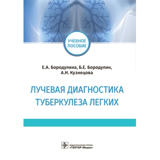 Лучевая диагностика туберкулеза легких : учебное пособие Е. А. Бородулина, Б. Е. Бородулин, А. Н. Кузнецова 2021 (Гэотар)