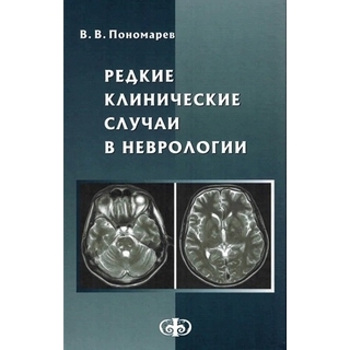 Редкие клинические случаи в неврологии Пономарев В.В. 2025 г. (Фолиант)