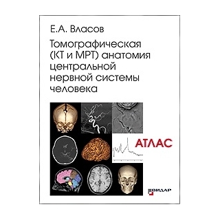 Томографическая (КТ и МРТ) анатомия центральной нервной системы человека. Атлас. Е.А.Власов 2020 г. (Видар) Томографическая (КТ и МРТ) анатомия центральной нервной системы человека. Атлас. Е.А.Власов 2020 г. (Видар)