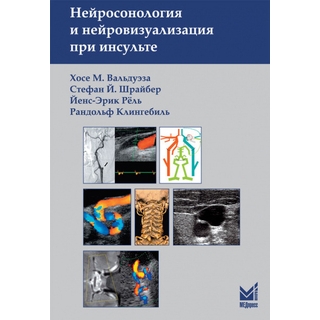 Нейросонология и нейровизуализация при инсульте. Вальдуэза Х.М., Шрайбер С.Й., 3 изд. 2024 г. (МЕДпресс)