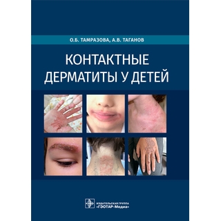 Контактные дерматиты у детей. О. Б. Тамразова, А. В. Таганов. 2022 г. (Гэотар) Контактные дерматиты у детей. О. Б. Тамразова, А. В. Таганов. 2022 г. (Гэотар)