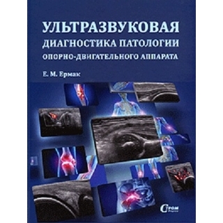 Ультразвуковая диагностика патологии опорно-двигательного аппарата Ермак Е.М. 2015 г. (СтромФирма) Ультразвуковая диагностика патологии опорно-двигательного аппарата Ермак Е.М. 2015 г. (СтромФирма)