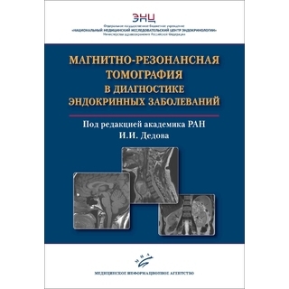 Магнитно-резонансная томография в диагностике эндокринных заболеваний. А.В. Воронцов, В.П. Владимирова, Д.М. Бабаева под ред И.И. Дедова. 2021 г. (МИА) Магнитно-резонансная томография в диагностике эндокринных заболеваний. А.В. Воронцов, В.П. Владимирова, Д.М. Бабаева под ред И.И. Дедова. 2021 г. (МИА)