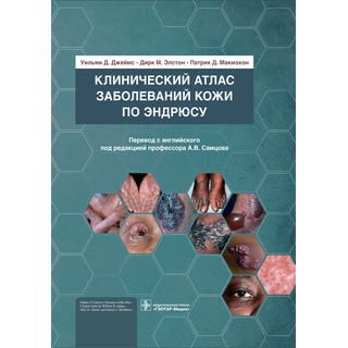 Клинический атлас заболеваний кожи по Эндрюсу. Уильям Д. Джеймс, Дирк М. Элстон, Патрик Д. Макмэхон 2021 г. (Гэотар) Клинический атлас заболеваний кожи по Эндрюсу. Уильям Д. Джеймс, Дирк М. Элстон, Патрик Д. Макмэхон 2021 г. (Гэотар)
