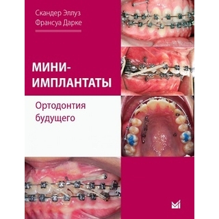 Мини-имплантаты. Ортодонтия будущего. Скандер Эллуз, Франсуа Дарке 2027 г. (МЕДпресс)