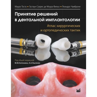 Принятие решений в дентальной имплантологии. Атлас хирургических и ортопедических тактик - Тоста, Мауро 2020г. (МедПресс) Принятие решений в дентальной имплантологии. Атлас хирургических и ортопедических тактик - Тоста, Мауро 2020г. (МедПресс)