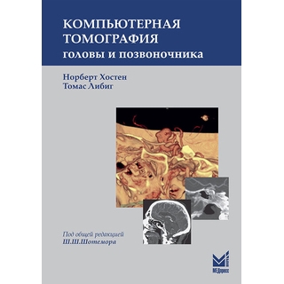 Компьютерная томография головы и позвоночника Хостен Н. Либиг Т. 2017 г. (МЕДпресс) Компьютерная томография головы и позвоночника Хостен Н. Либиг Т. 2017 г. (МЕДпресс)