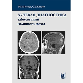 Лучевая диагностика заболеваний головного мозга Китаев В.М. С.В.Китаев 2024 г. (МЕДпресс)
