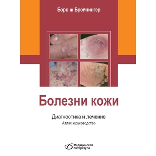 Болезни кожи. Диагностика и лечение. Атлас и руководство К. Борк 2015 г. (Медицинская литература) (Копия) Болезни кожи. Диагностика и лечение. Атлас и руководство К. Борк 2015 г. (Медицинская литература) (Копия)