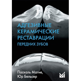 Адгезивные керамические реставрации передних зубов Манье П. 2024 г. (МЕДпресс)