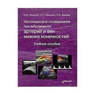 Ультразвуковое исследование при заболеваниях артерий и вен нижних конечностей. Носенко Е.М., Носенко Н.С., Дадова Л.В. 2021 г. (Видар)