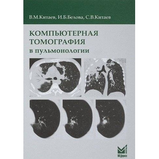 Компьютерная томография в пульмонологии Китаев В.М. 2024 г. (МЕДпресс) Компьютерная томография в пульмонологии Китаев В.М. 2024 г. (МЕДпресс)