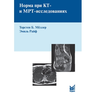 Норма при КТ и МРТ исследованиях Мёллер Т.Б. Райф Э. 2026 г. (МЕДпресс)