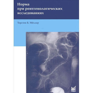 Норма при рентгенологических исследованиях Мёллер Т.Б. 2025 г. (МЕДпресс) Норма при рентгенологических исследованиях Мёллер Т.Б. 2025 г. (МЕДпресс)