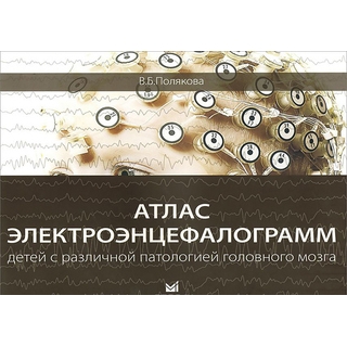 Атлас электроэнцефалограмм детей с различной патологией головного мозга Полякова 2018 г. (МЕДпресс) Атлас электроэнцефалограмм детей с различной патологией головного мозга Полякова 2018 г. (МЕДпресс)