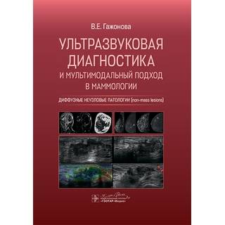 Ультразвуковая диагностика и мультимодальный подход в маммологии. Диффузные неузловые патологии (non-mass lesions) В. Е. Гажонова 2025 г. (Гэотар)