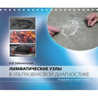 Лимфатические узлы в ультразвуковой диагностике. Заболотская Н.В. 2025 г. (МедПресс)