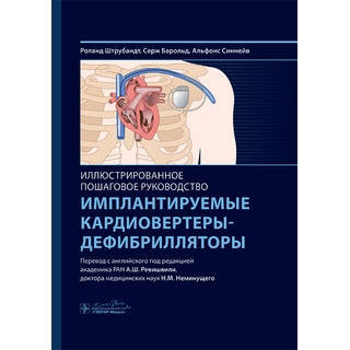 Имплантируемые кардиовертеры-дефибрилляторы. Иллюстрированное пошаговое руководство / Р. Штрубандт, С. Барольд, А. Синнейв 2025 г. (Гэотар) Имплантируемые кардиовертеры-дефибрилляторы. Иллюстрированное пошаговое руководство / Р. Штрубандт, С. Барольд, А. Синнейв 2025 г. (Гэотар)