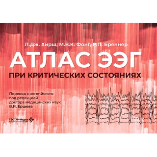 Атлас ЭЭГ при критических состояниях. Л. Дж. Хирш, М. В. К. Фонг, Р. П. Бреннер 2026 г. (Гэотар) Атлас ЭЭГ при критических состояниях. Л. Дж. Хирш, М. В. К. Фонг, Р. П. Бреннер 2026 г. (Гэотар)